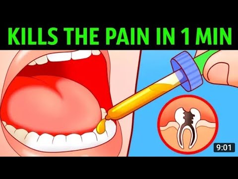 10 Ways to Kill a Toothache In a Minute360p