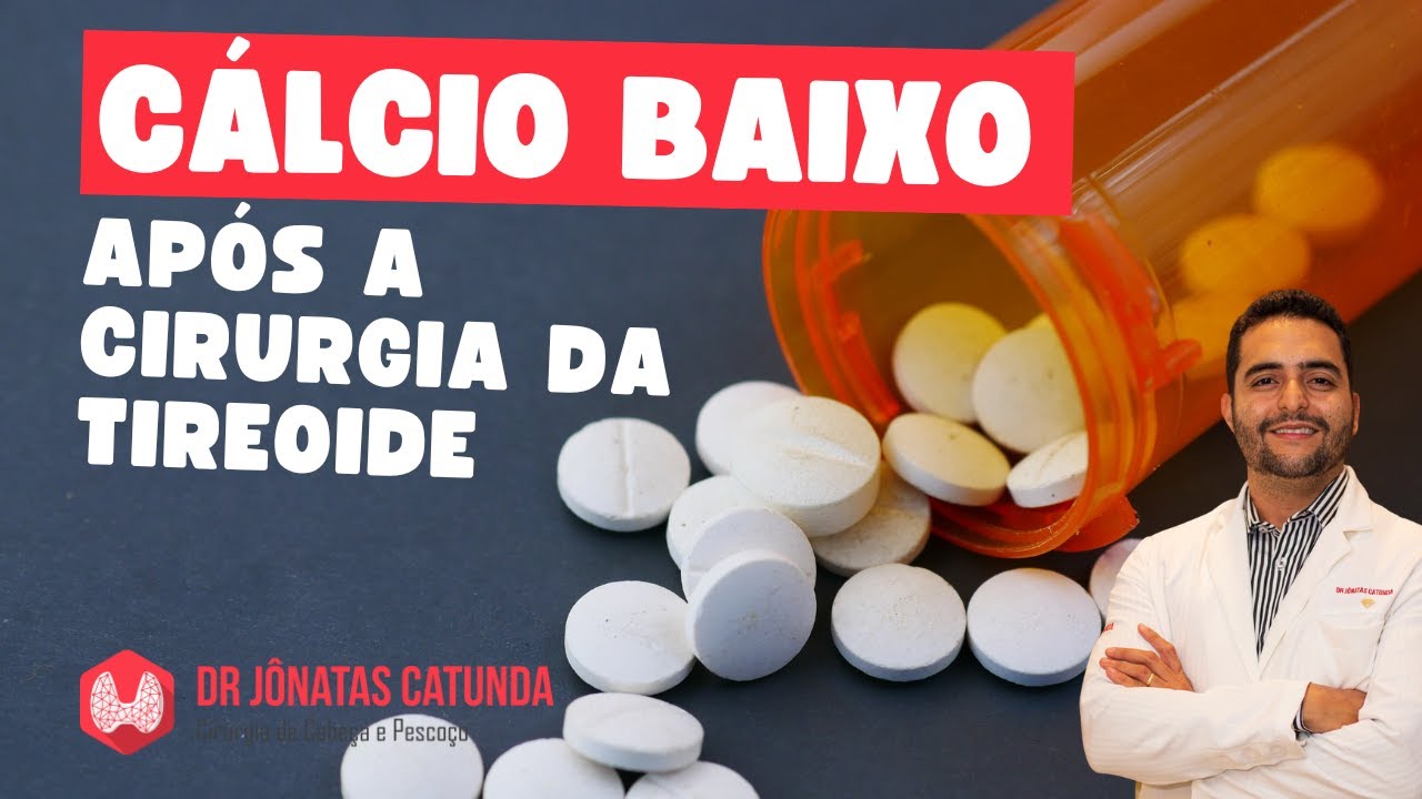 Queda do cálcio após a tireoidectomia - Caimbras, formigamentos, dormência