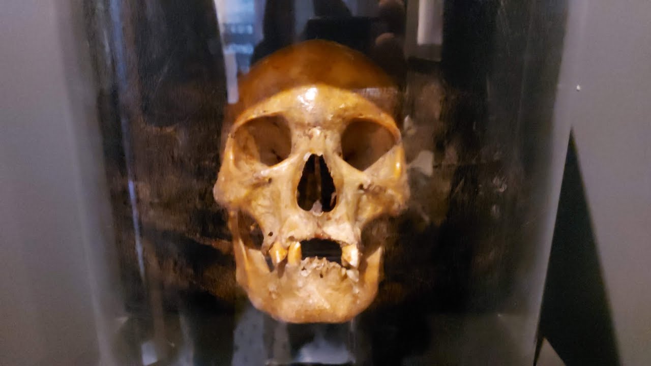 Evento de Barbacena-MG ep.09     Museu da Loucura,cenas fortes...