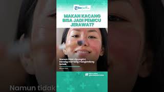 Benarkah Konsumsi Kacang Dapat Memicu Timbulnya Jerawat di Wajah, Begini Fakta dan Penyebabnya