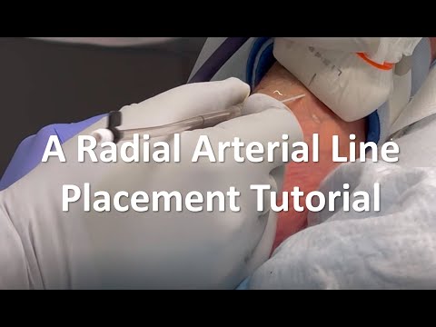 A Radial Arterial Line Placement Tutorial