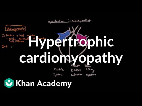 Hypertrophic cardiomyopathy: Pathophysiology and diagnosis | NCLEX-RN | Khan Academy