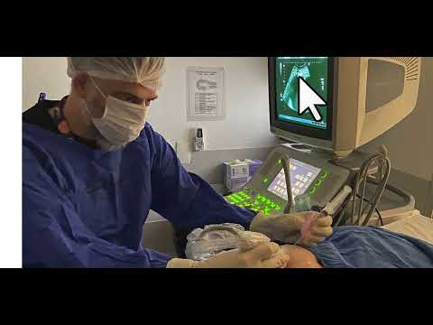 Punção de hematometra guiada por ultrassonografia