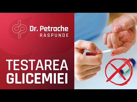 tratamentul cartofului varicos merita îndepartarea venelor în varicoza