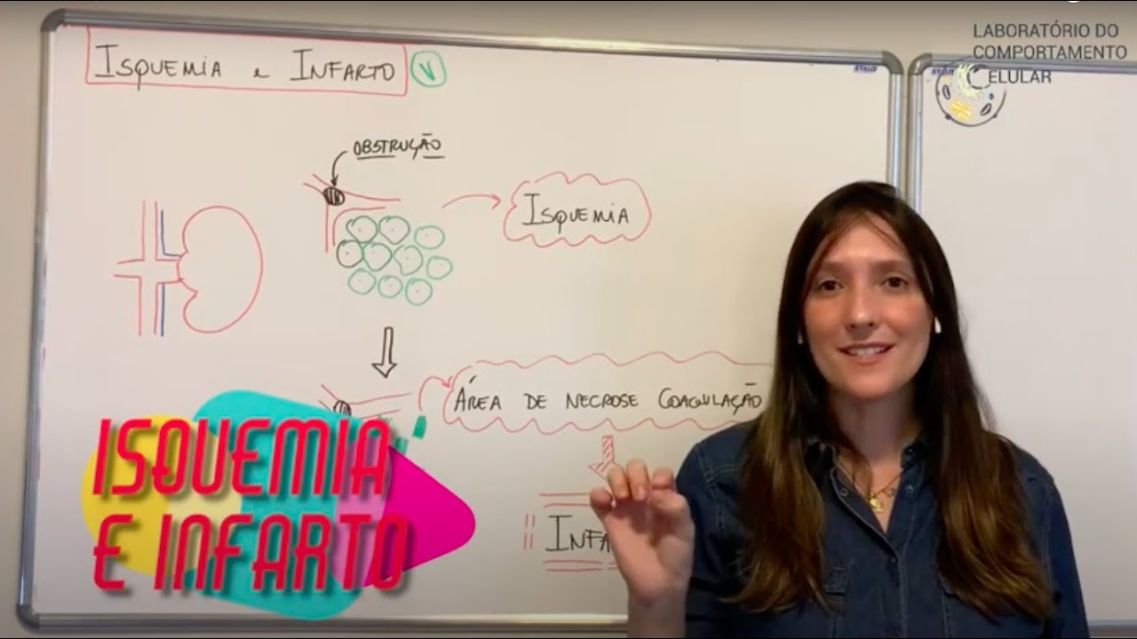 Vídeo 9 - Isquemia e Infarto