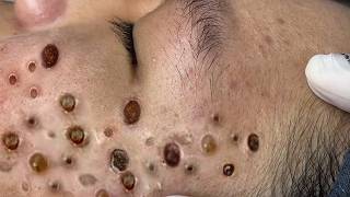 𝐑𝐞𝐟𝐫𝐞𝐬𝐡 𝐘𝐨𝐮𝐫 𝐅𝐚𝐜𝐞 𝐖𝐢𝐭𝐡 LNG 𝐒𝐤𝐢𝐧 𝐂𝐚𝐫𝐞 #