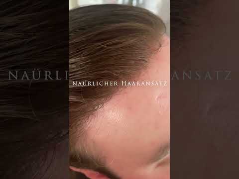 Neues Haarsystem - Hairsystem mit 0,03 mm Folie