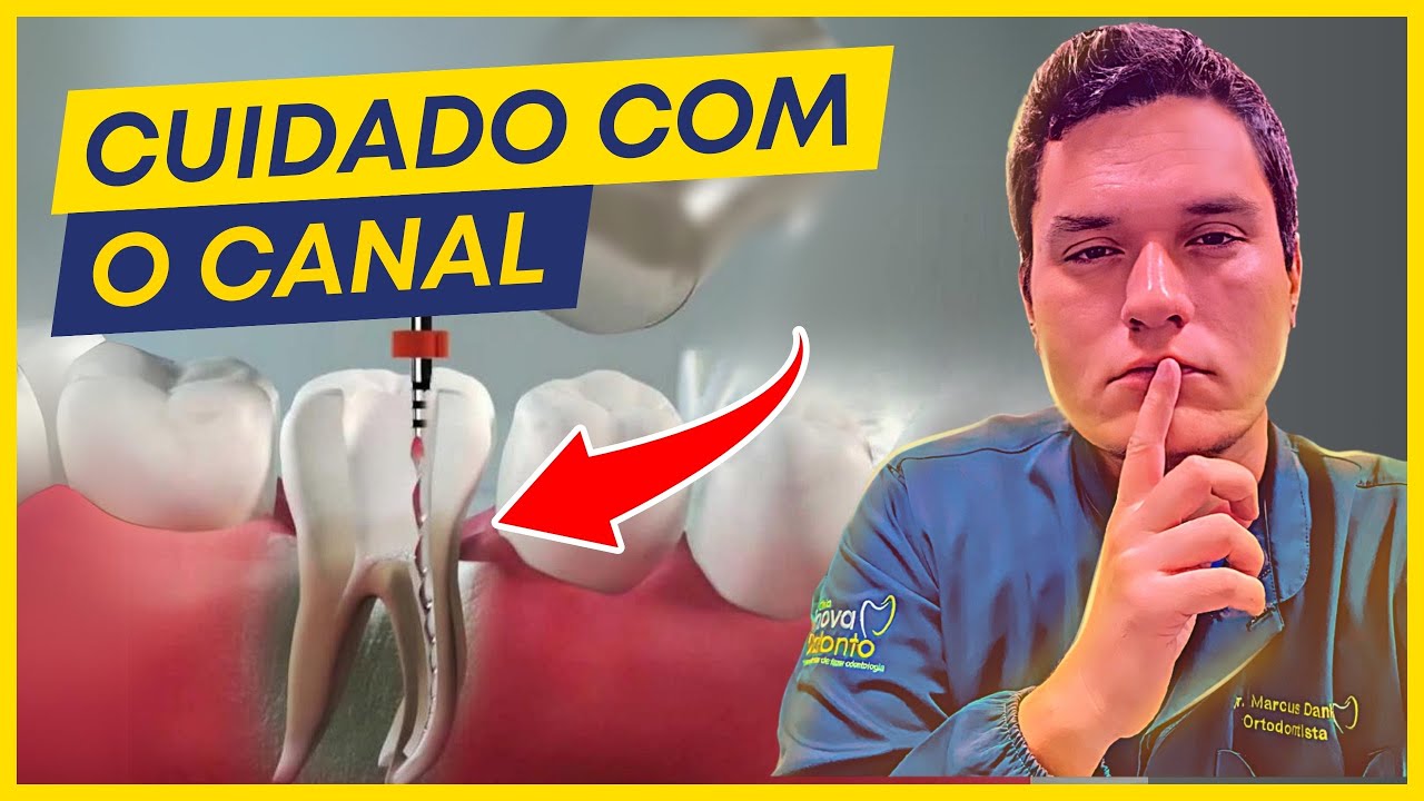 10 HIDDEN Dangers of ROOT CANAL TREATMENT (That you didn't know).