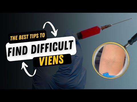 Trouble Locating & Palpating Difficult Veins? Here are The BEST TIPS to Stick That Vein!!
