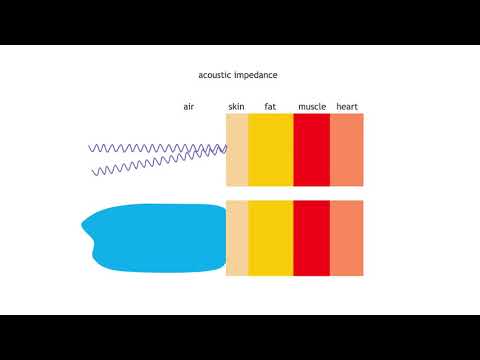 Ultrasound Physics | British Society of Echocardiography Theory Exam Revision