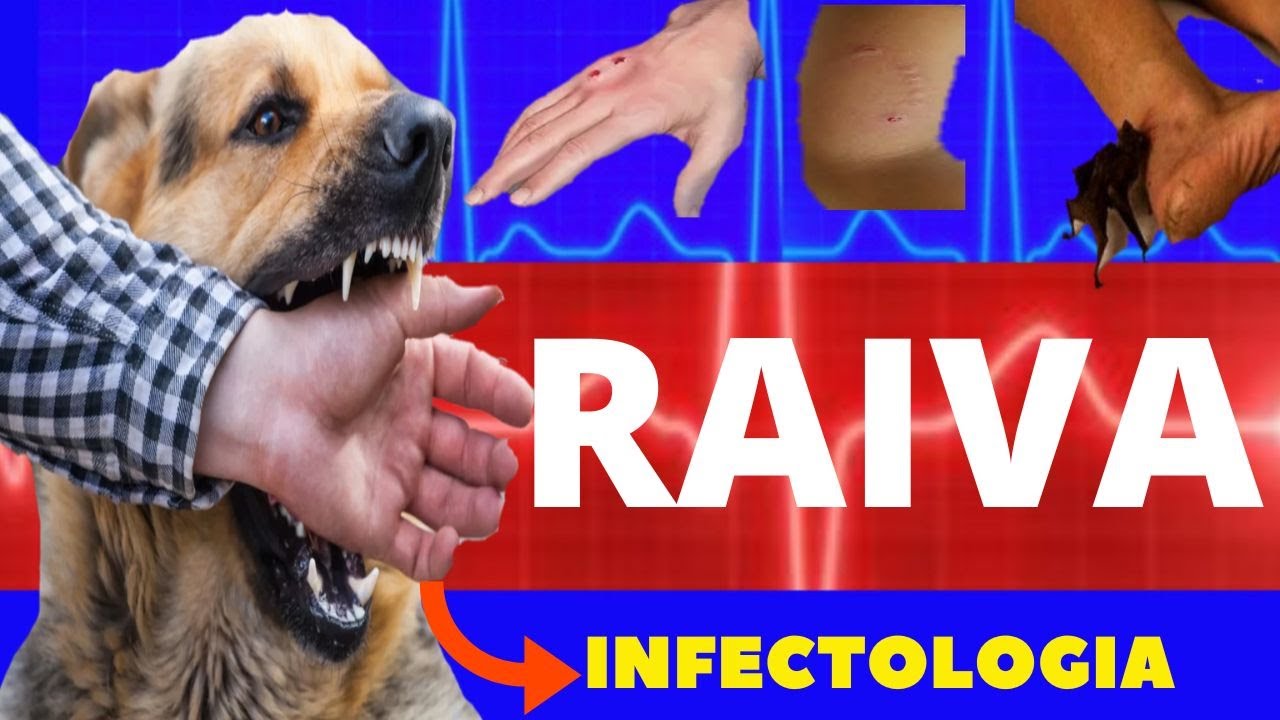 RAIVA HUMANA - VÍRUS DA RAIVA - CAUSAS, SINTOMAS, DIAGNÓSTICO E TRATAMENTO - INFECTOLOGIA