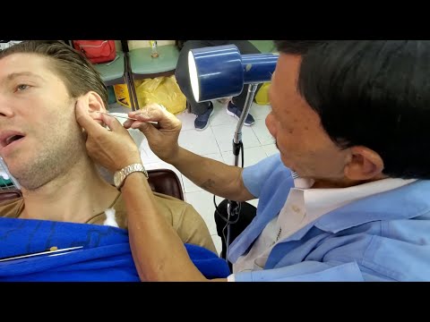 download lagu mp3 mp4 Thai Ear Cleaning, download lagu Thai Ear Cleaning gratis, unduh video klip Thai Ear Cleaning