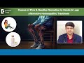 Pins & Needles Sensation-Hands & Legs-Alternative Homeopathy Cure-Dr.Sanjay Panicker|Doctors’ Circle