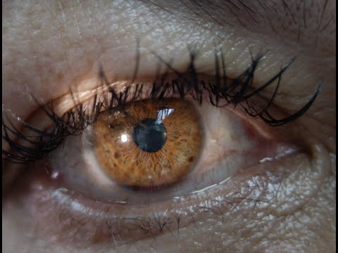 Ojos de color
