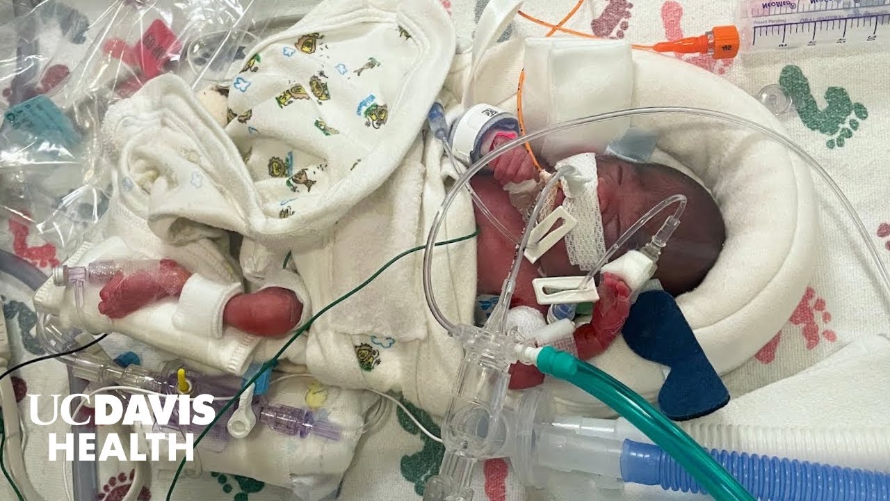 Thumbnail preview of Baby Born at 22 Weeks Saved by Sacramento Firefighters and UC Davis