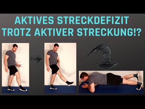Aktives Streckdefizit im Knie nach Kreuzbandriss besser verstehen