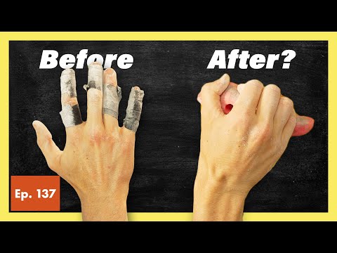 Do Climbers Really Need Deload Weeks?