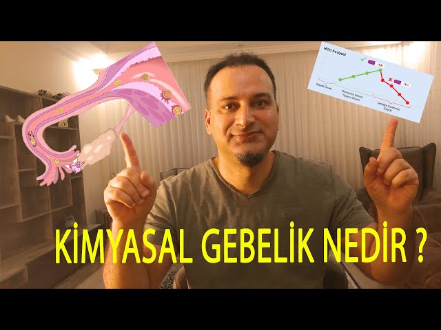 הגיית וידאו של kimyasal בשנת טורקית