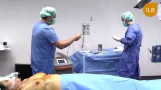 REDUCCION MAMARIA - Dr Marín - Instituto Laser Barcelona