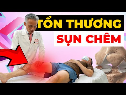 Đau Khớp Gối Kéo Dài? Cẩn Thận Sụn Chêm Đã BỊ RÁCH!