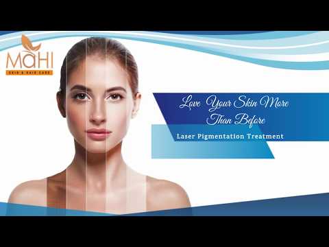 Laser skin pigmentation treatment