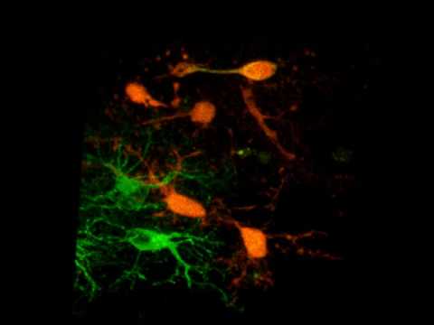 Imaging Cytoskeletal Dynamics (Microtubules) thumbnail