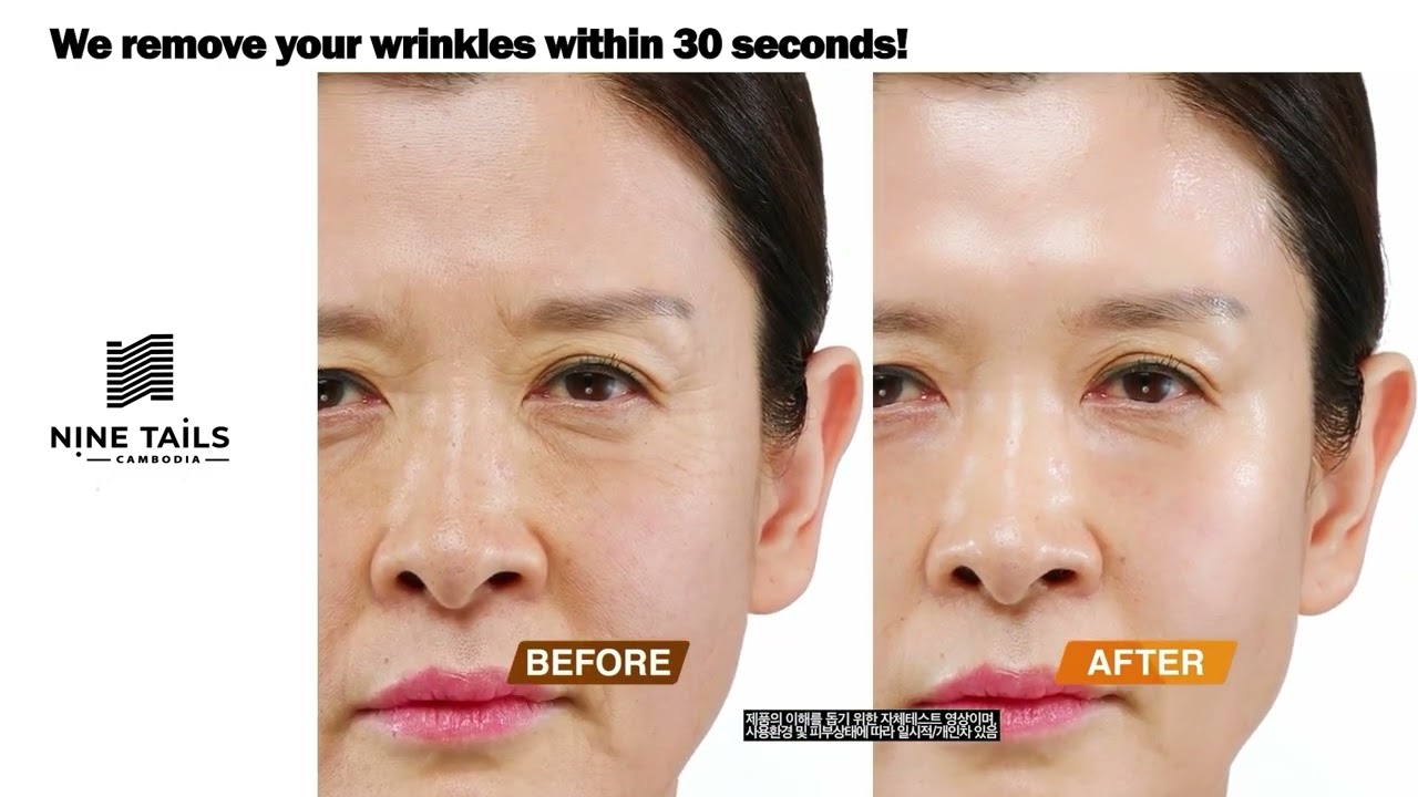 Video thumbnail – Nine Tails Line Lift Serum