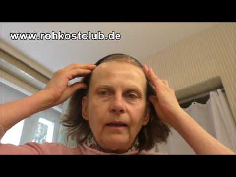 Die Diät bei atopitscheskom die Hautentzündung das Kind die 2 Jahre Die Gräser die bei der Schuppenflechte helfen