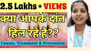 How to save Mobile/Loose Teeth || Causes, Grading & Treatment || Oral Health || Dental Health ||