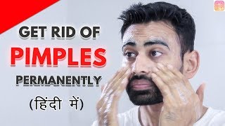 Get Rid of Pimples & Acne Permanently in 2 Steps (Works 100%) | Fit Tuber Hindi