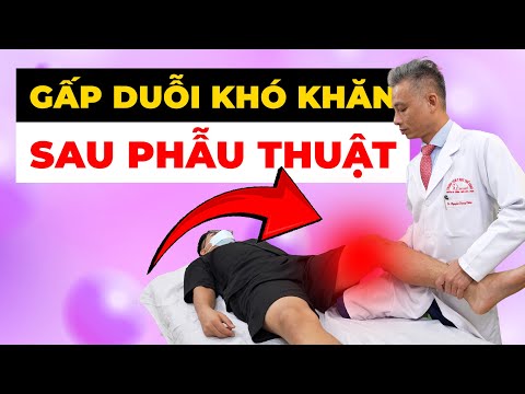 Khớp Gối Cứng Đơ Sau Mổ - Đau Đớn Khi Gấp Duỗi? Bác Sĩ Hé Lộ Cách Phục Hồi