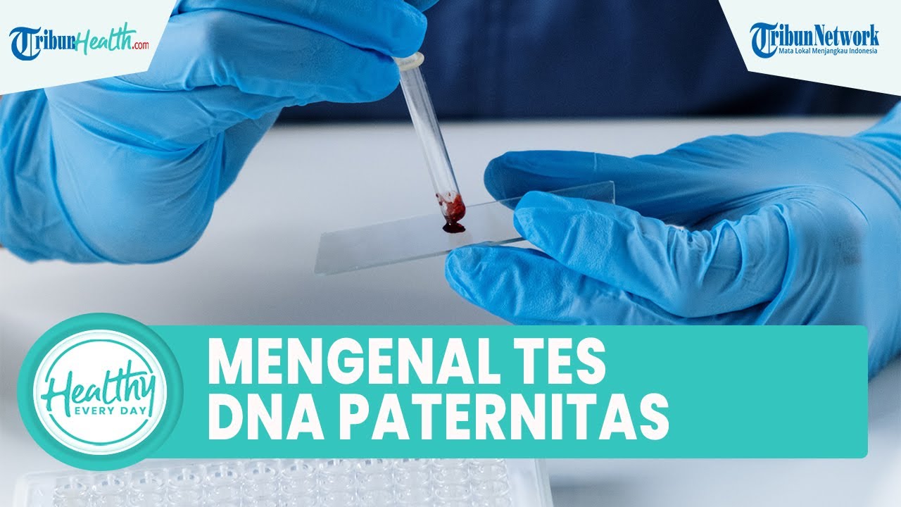 Apa itu Tes DNA Paternitas Inilah Proses Menentukan Hubungan Orangtua dan Anak yang Akurat