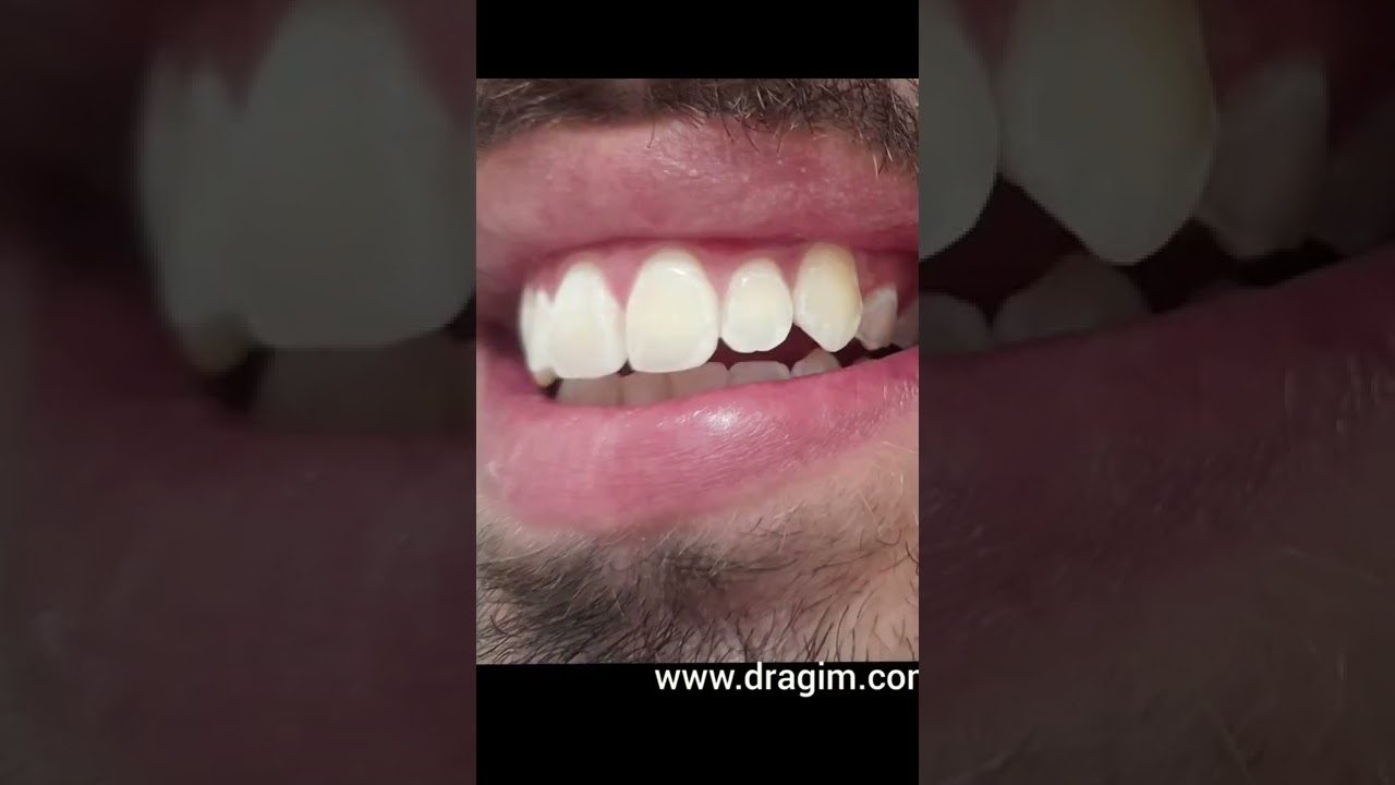 Gislene Isabel De Mendonça-29