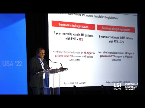 Nyra Medical | Murali Padala, CEO & Founder