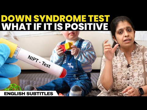 Down Syndrome Test - What If It Is Positive | டவுன் சிண்ட்ரோம் இருப்பதை எப்படி தெரிந்து கொள்வது?