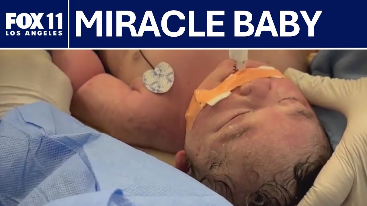 Pregnancy in America: A Growing Health Concern