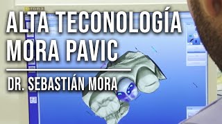 CEREC tecnología de punta, reduce tiempos de instalación de piezas dentales.  Clínica Mora Pavic