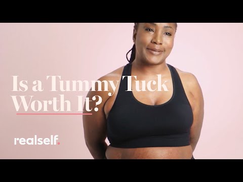 Is a Tummy Tuck Worth It? Everything You Need to Know About This Body-Contouring Surgery