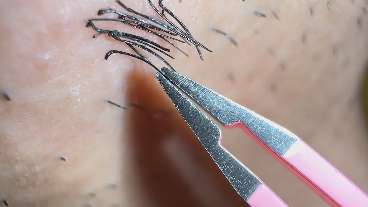 Plucking facial hair 1428 頬髭抜き