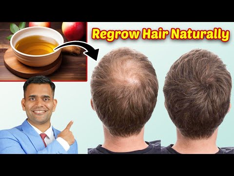 Stop Hair Fall , Hair Thinning and Regrow Hair Naturally - Dr. Vivek Joshi