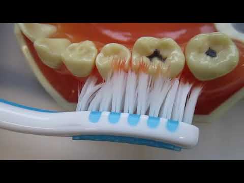 Trisa - Pro Interdental Toothbrush