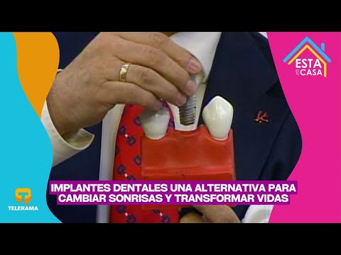 Implantes dentales una alternativa para cambiar sonrisas y transformar vidas
