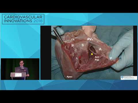 CVI2018 Session: Gross applicable anatomy of the tricuspid valve - Douglas Shook, MD