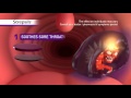 Strepsils Max Triple Action TVC