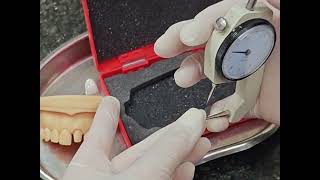 Phục hình răng bằng công nghệ CAD/CAM