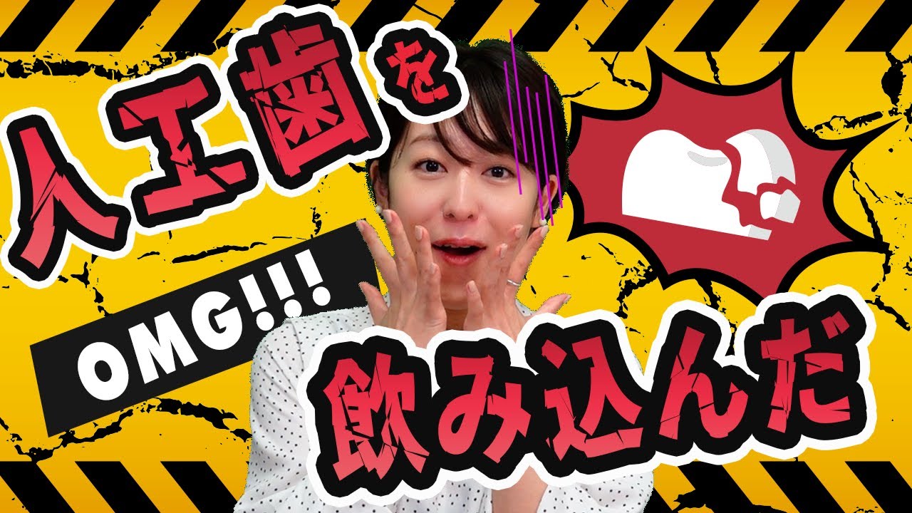 【インプラント】【審美歯科】被せ物の一部を飲み込んでしまった場合どうなる?