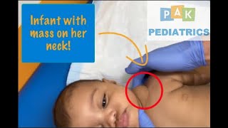 Infant with mass on her neck | Cystic Hygroma