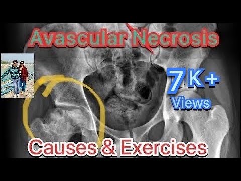 Watch our latest video on YouTube