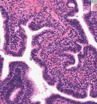 Shotgun Histology Fallopian Tube