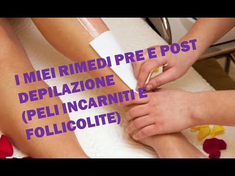 Il tutore sulla caviglia prezzo fotografico comune Giunti rigidi dopo Tavanic